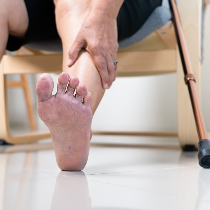 Morton’s-Neuroma–Anatomical-Explanation